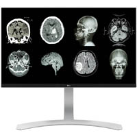 lg 27 inch 8mp clinical review monitor