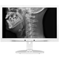 philips c240p4qpyew 24 inch lcd with clinical d-image monitor